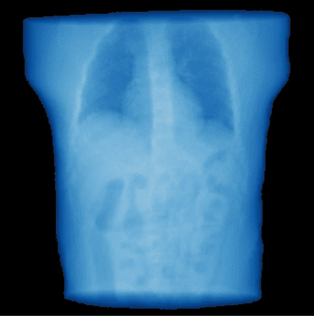 New open source medical imaging tools