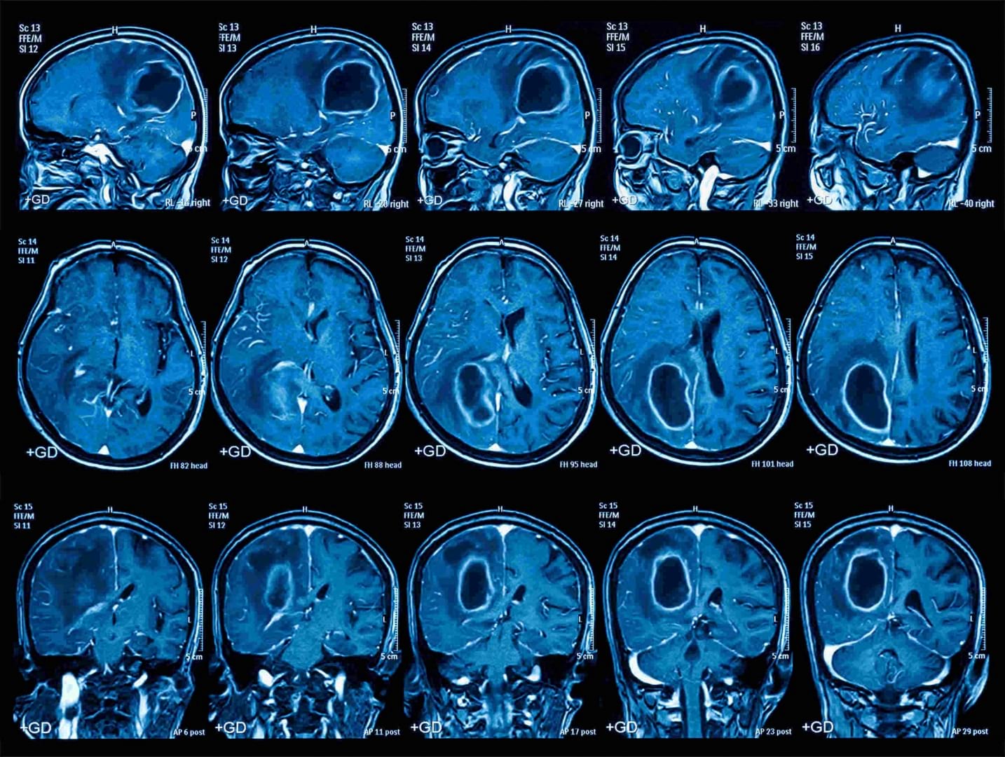 brain scan images