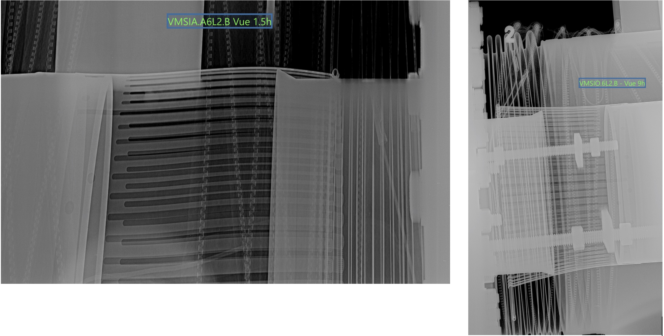 2 black and white X-ray images with green text over the top that reads VMSIA.A6L2.B Vue 1.5h (left) and VMSIO.6L2.B - Vue 9h
