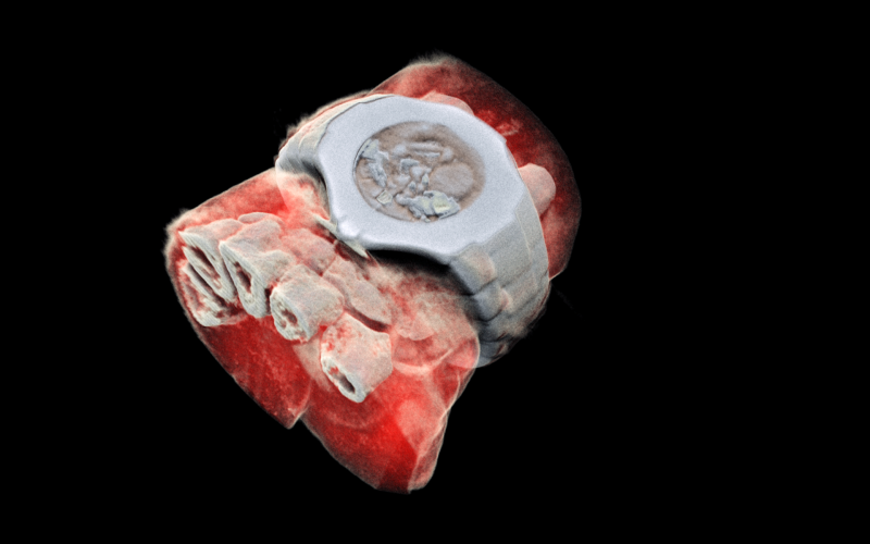 View of a 3D colour X-Ray of a human hand.