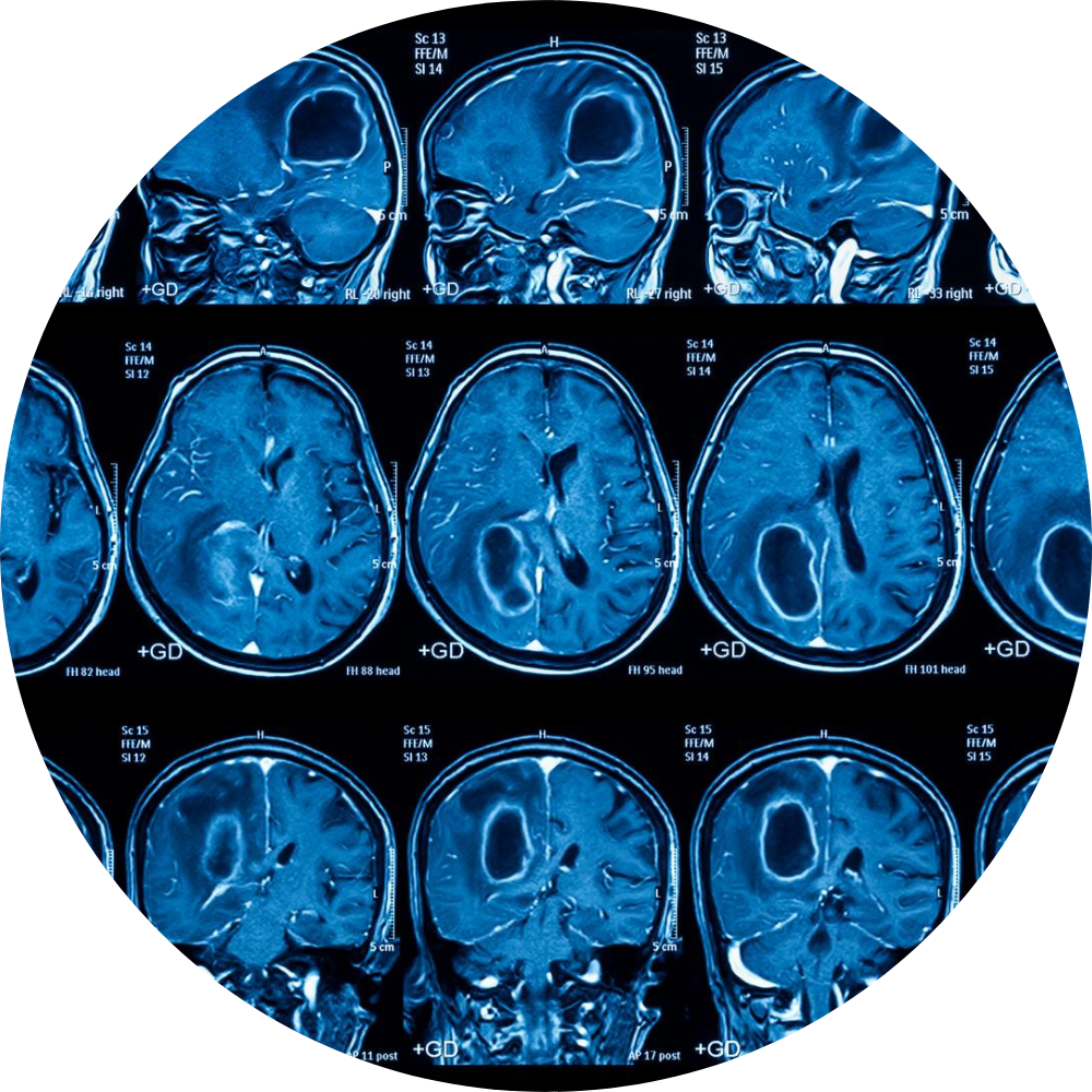 Multiple scans of brain
